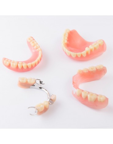 Acrylic dental prosthesis (acrylic dentures)