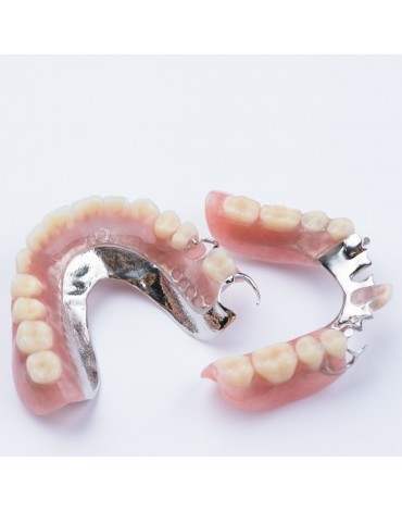 Cobalt chrome dental prosthesis