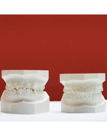 Modelos de estudio (réplica de la estructura dental)