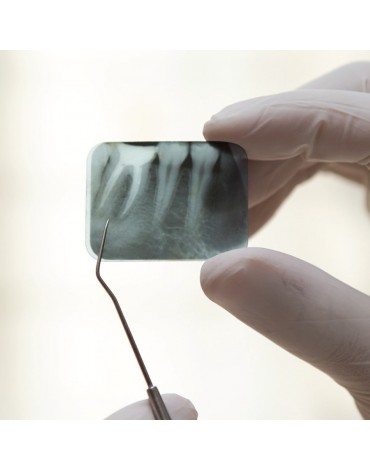 Periapical radiography (conventional fin)