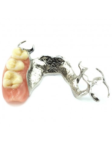 Partial removable metal prosthesis (chrome - cobalt)