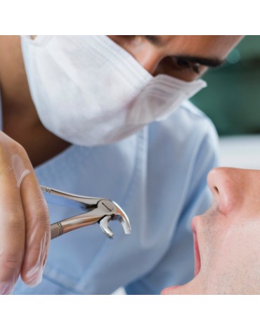 Complex tooth extraction (complicated extraction)