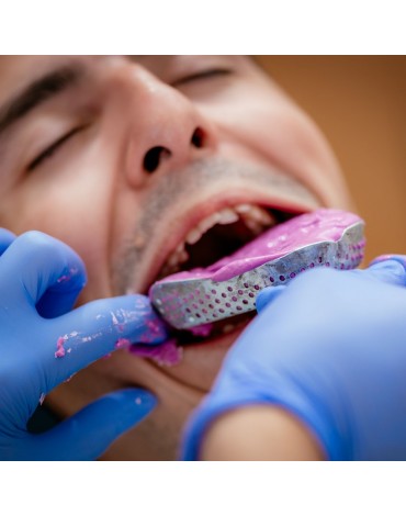 Study models (replica of the dental structure)