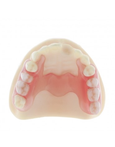 Immediate Acrylic Removable Partial Prosthesis (Immediate Acrylic Removable Partial Dentures)