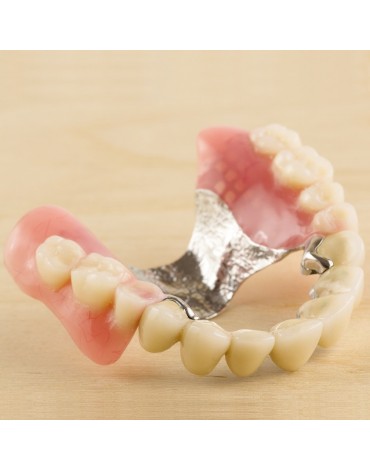 Total removable total metal acrylic base prosthesis