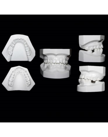 Study models (replica of the dental structure)