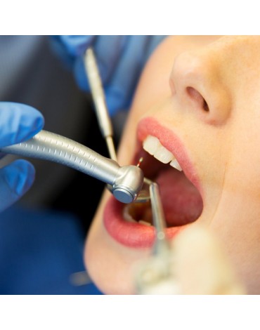  Endodoncia molar Multirradicular (tratamiento de nervio en muelas)
