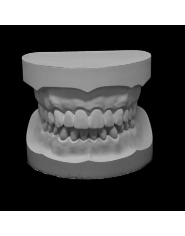 Modelos de estudio (réplica de la estructura dental)  