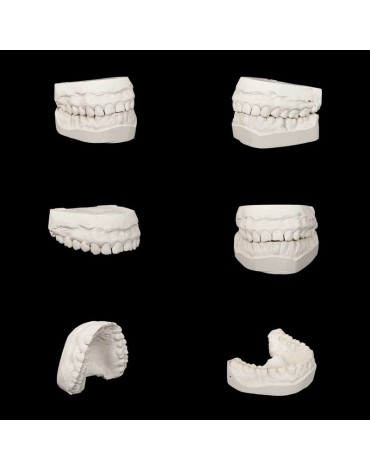 Modelos de estudio (réplica de la estructura dental)