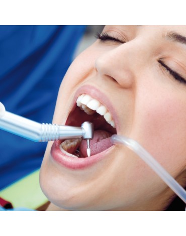 Limpieza dental o profiláctica + flúor + IFO no incluye raspado (limpieza dental preventiva)   