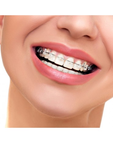 Pre-surgical orthodontics