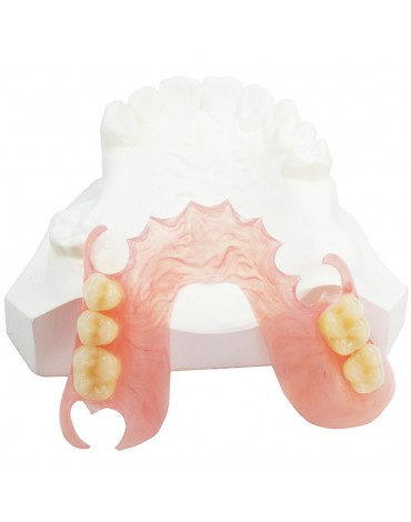 Immediate Acrylic Removable Partial Prosthesis (Immediate Acrylic Removable Partial Dentures)