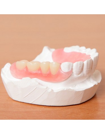 Flexible removable partial dentures (flexible removable partial dentures)