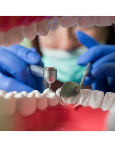 Multiradicular molar endodontics (nerve treatment in molars)