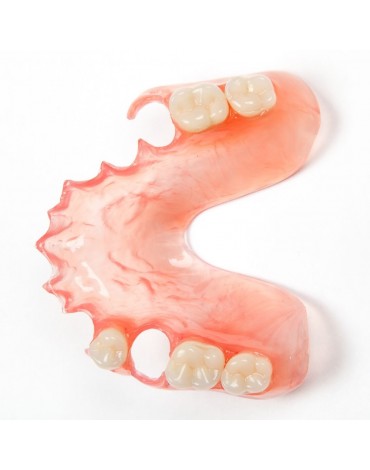 Flexible removable partial dentures (flexible removable partial dentures)