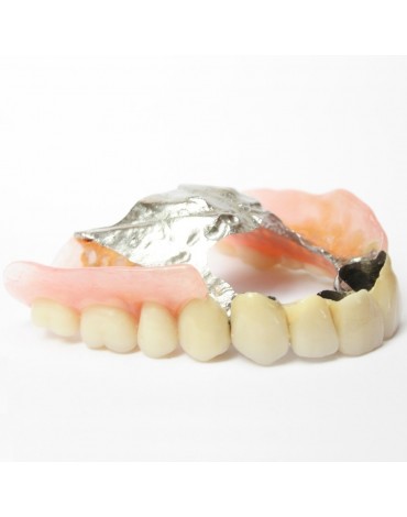 Total removable total metal acrylic base prosthesis