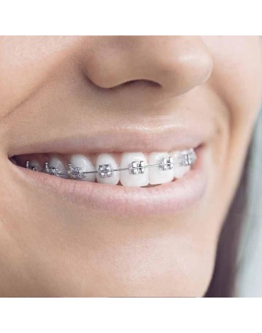Metallic fixed orthodontics