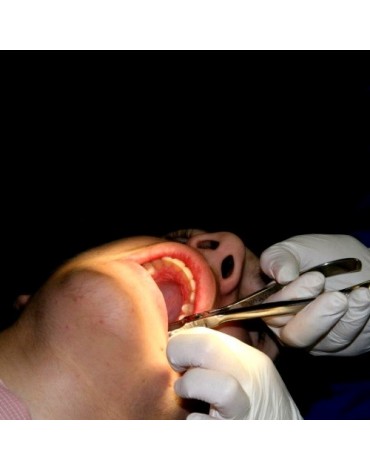 Exodontics (tooth extraction)