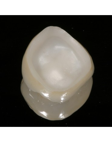 Zirconium crown (zirconium case)