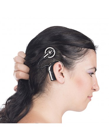 Cochlear implant