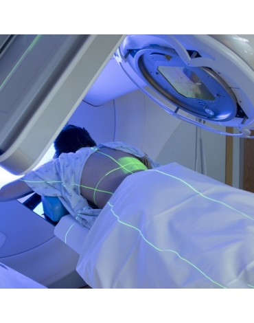 Radiotherapy by modulated intensity (IMRT)
