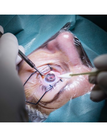 Anterior lamellar corneal transplant (each eye)