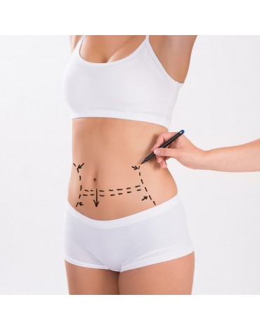 Liposucción de abdomen anterior y lateral