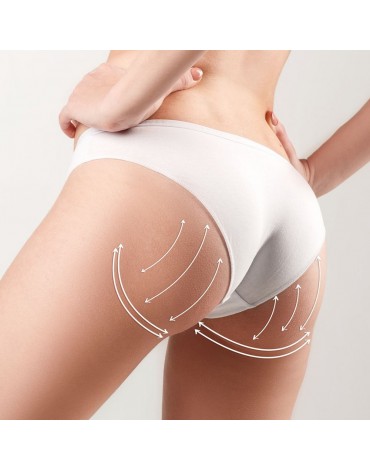 Buttock implants