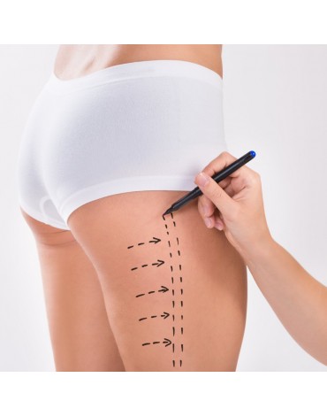 Lower limb liposuction