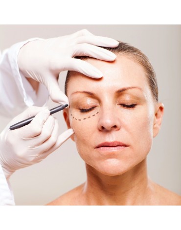 Blepharoplasty