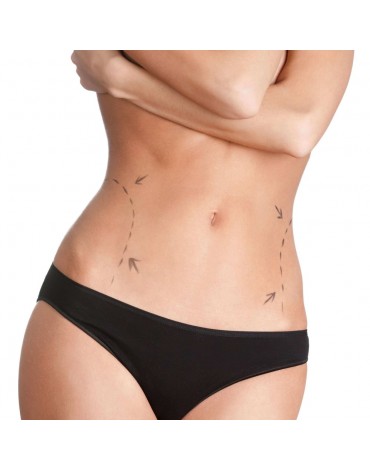 Lipoabdominoplastia