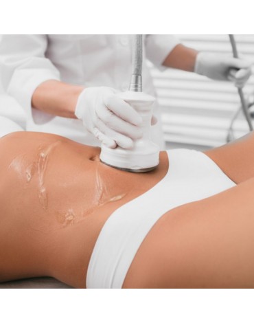 Laser assisted liposuction back and abdomen