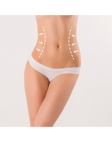 Liposculpture