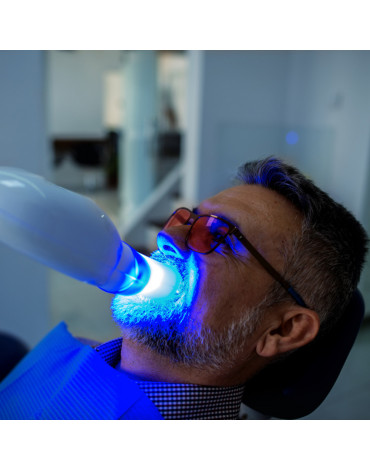 Laser whitening