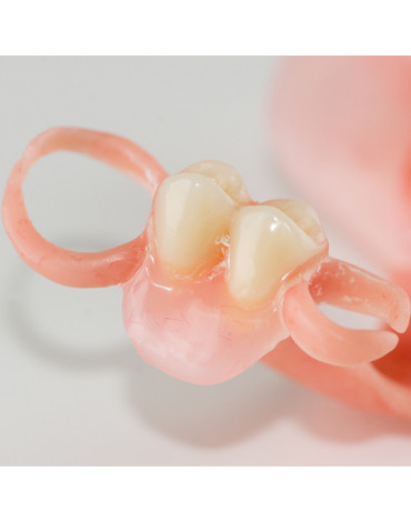 Removable prosthesis of 1 to 3 units