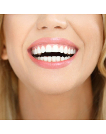 Teeth whitening