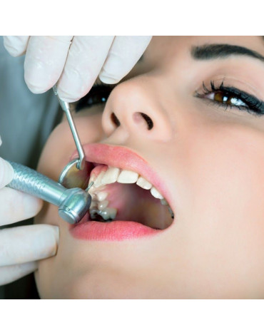 Endodoncia en molares